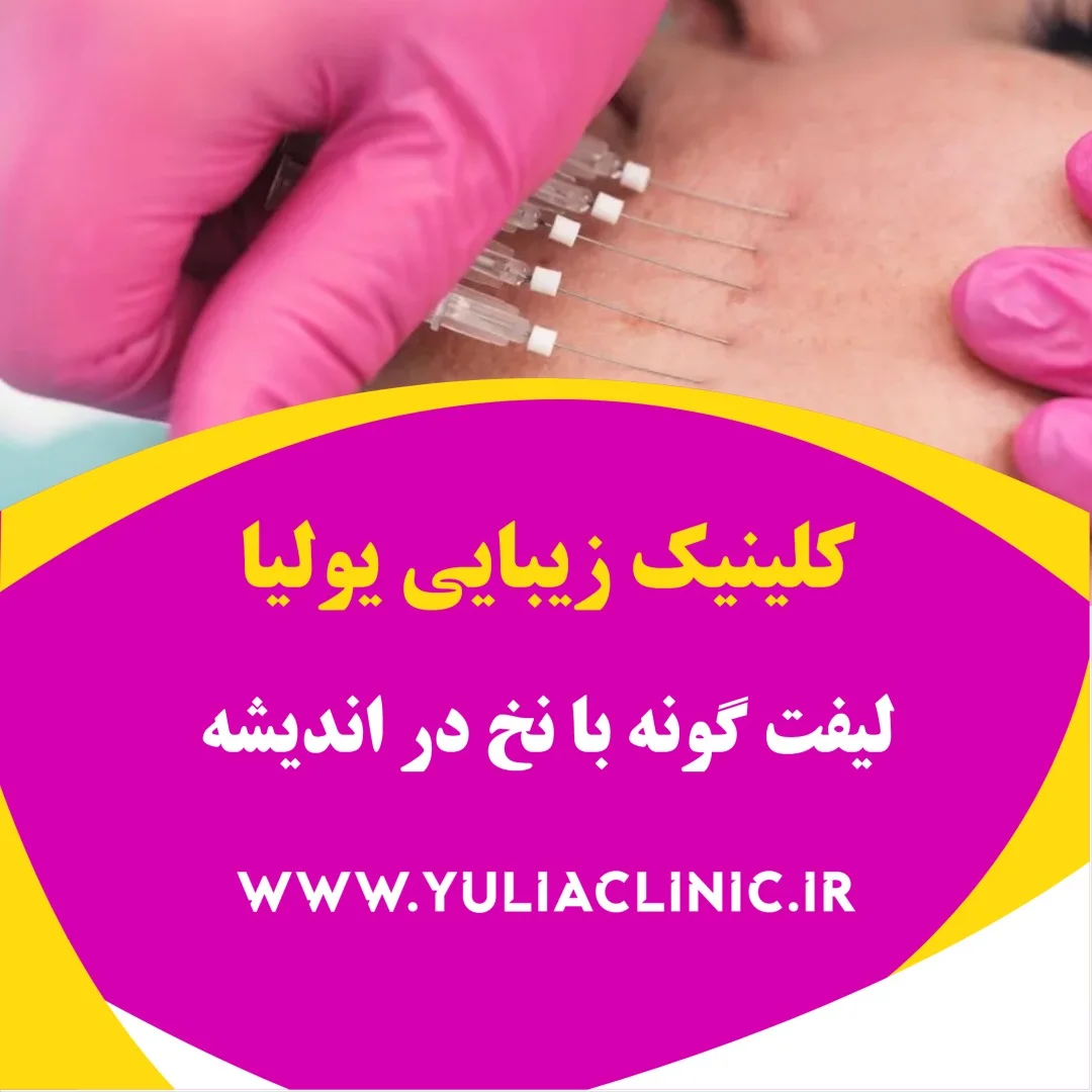 راهنمای لیفت گونه با نخ و نکات مهم پیش از درمان