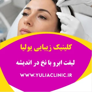 راهنمای لیفت ابرو با نخ و نکات مهم پیش از درمان