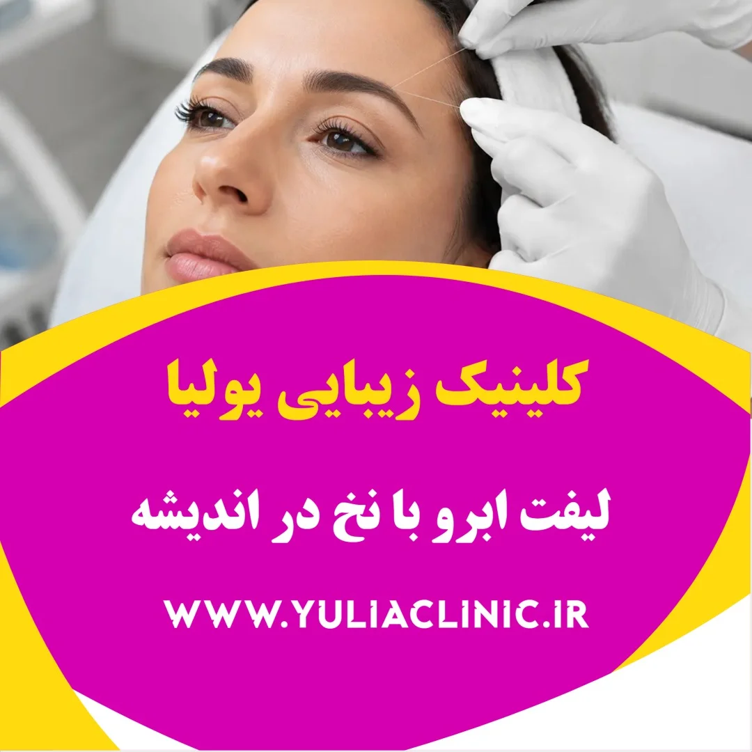 راهنمای لیفت ابرو با نخ و نکات مهم پیش از درمان