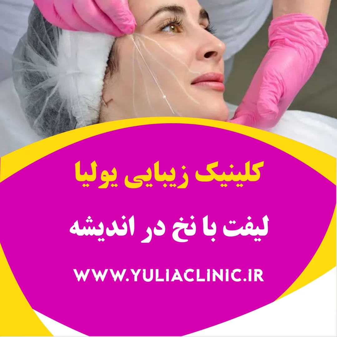 مشاوره پزشکی درباره لیفت با نخ صورت در اندیشه