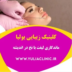 عوامل مؤثر بر ماندگاری لیفت با نخ