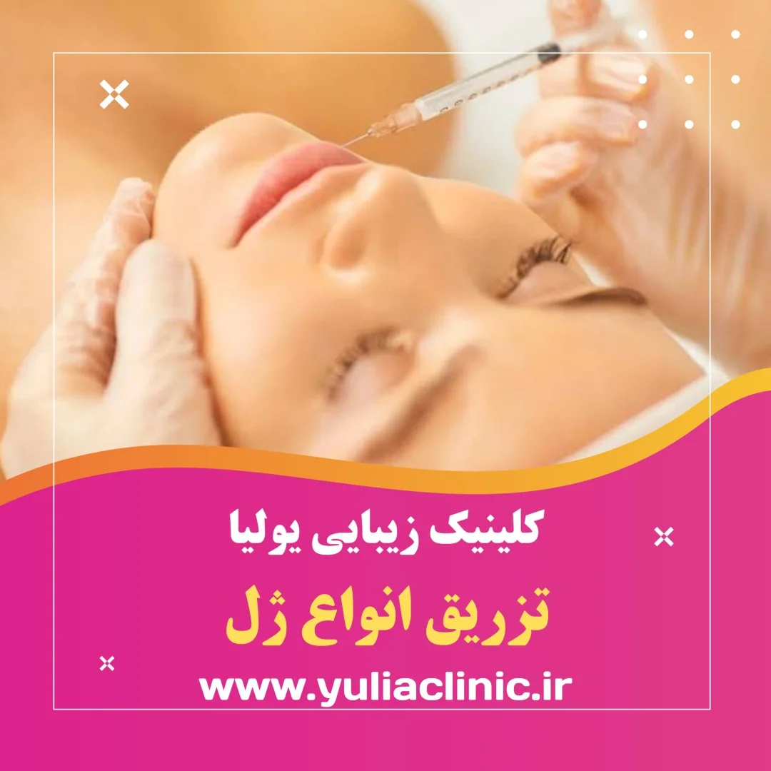 تزریق انواع ژل زیبایی صورت در کلینیک زیبایی یولیا