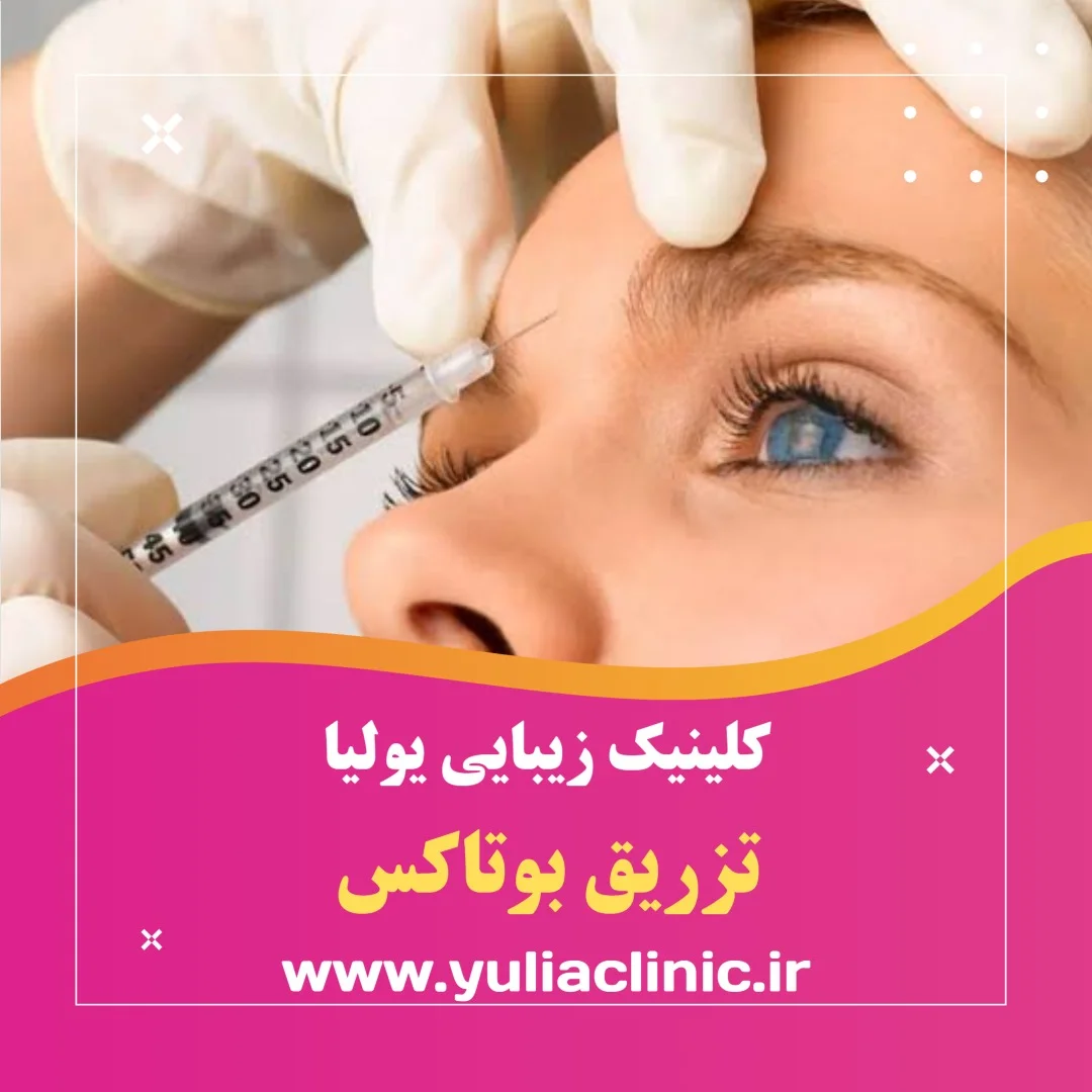 تزریق بوتاکس توسط متخصص در کلینیک زیبایی یولیا