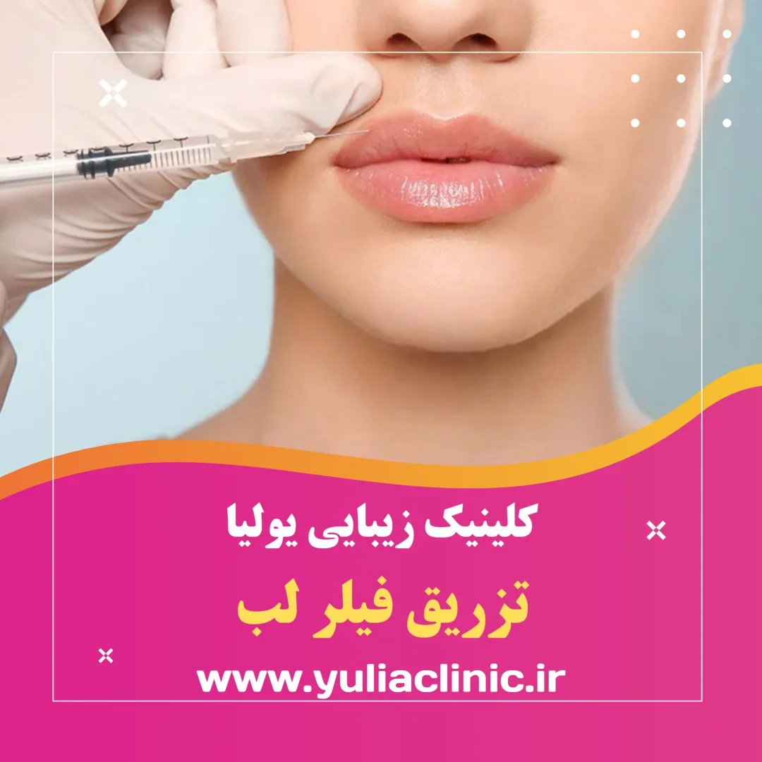 تزریق فیلر لب در کلینیک زیبایی یولیا