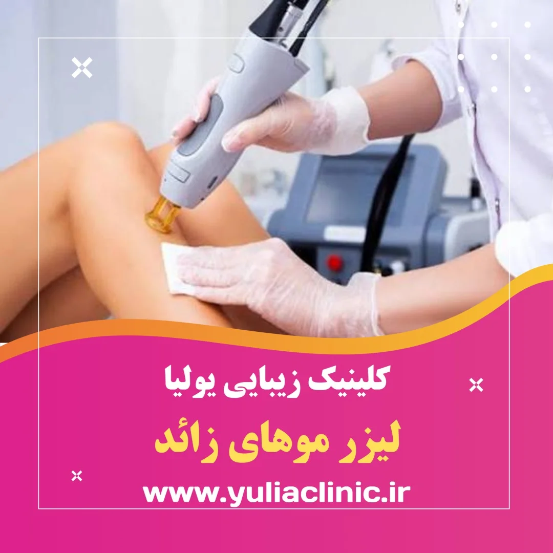 انجام لیزر موهای زائد با دستگاه لیزر در کلینیک زیبایی یولیا