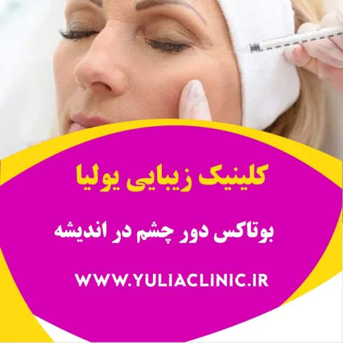 مشاوره درباره بوتاکس دور چشم برای کاهش خطوط پنجه‌کلاغی