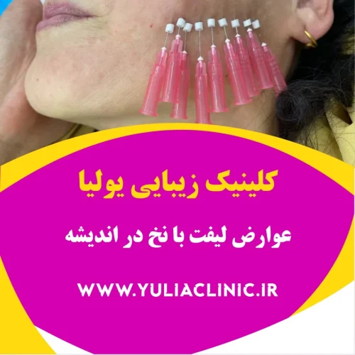 عوارض لیفت با نخ در اندیشه راهنمای عوارض احتمالی لیفت با نخ و نکات ایمنی
