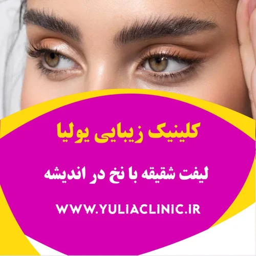 راهنمای لیفت شقیقه با نخ و نکات مهم پیش از درمان