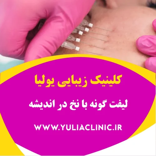 لیفت گونه با نخ در اندیشه راهنمای لیفت گونه با نخ و نکات مهم پیش از درمان